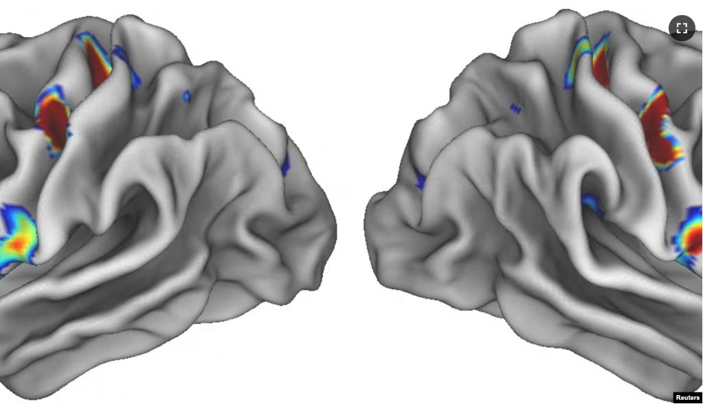 Three colored spots on each half of the brain show special locations in the movement areas of the brain that connect to areas involved in thinking, planning and control of basic bodily functions such as heart rate. (Evan Gordon/Washington University/Handout via REUTERS)