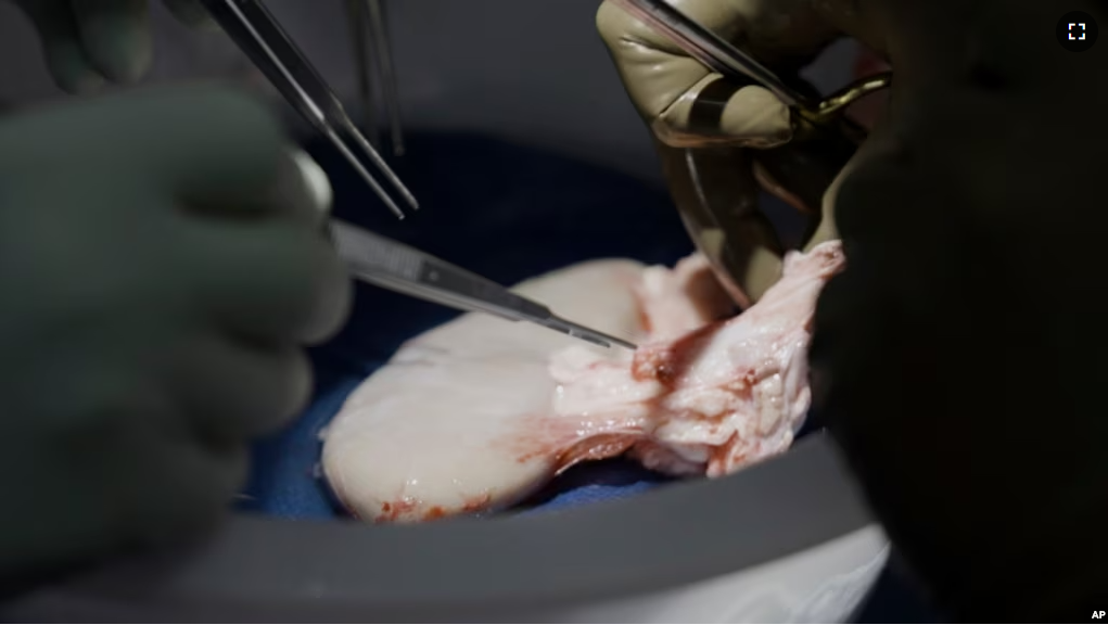 Surgeons at NYU Langone Health prepare to transplant a pig's kidney into a brain-dead man in New York on July 14, 2023. (AP Photo/Shelby Lum)