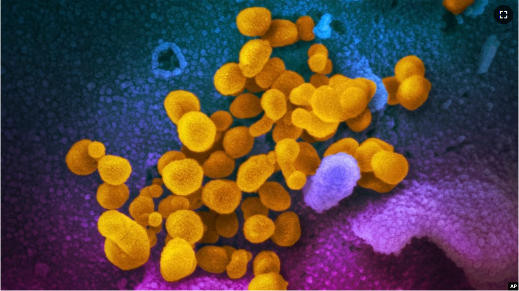 FILE - This undated, colorized electron microscope image made available by the U.S. National Institutes of Health in February 2020 shows the Novel Coronavirus SARS-CoV-2. (NIAID-RML via AP, File)