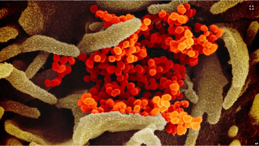 This image provided by The National Institute of Allergy and Infectious Diseases shows the SARS-CoV-2 virus. (NIAID-RML via AP)