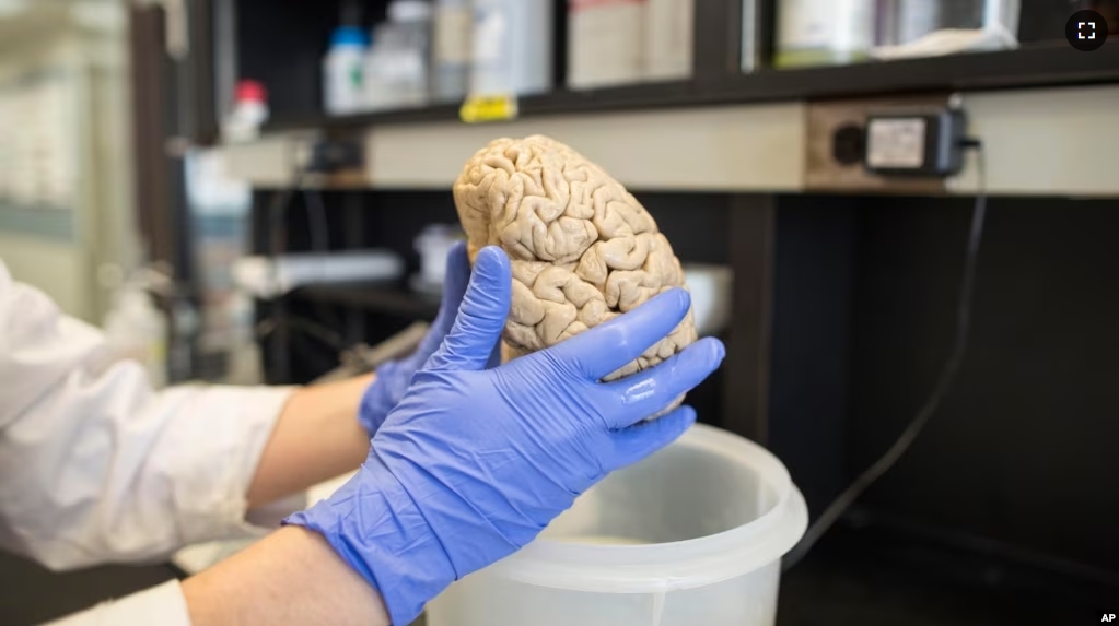 In this July 29, 2013 photo, a researcher holds a human brain in a laboratory at Northwestern University's cognitive neurology and Alzheimer's disease center in Chicago. (AP Photo/Scott Eisen)