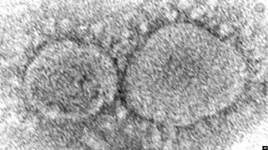 This 2020 electron microscope image made available by the Centers for Disease Control and Prevention shows SARS-CoV-2 virus particles which cause COVID-19.(Hannah A. Bullock, Azaibi Tamin/CDC via AP, File)