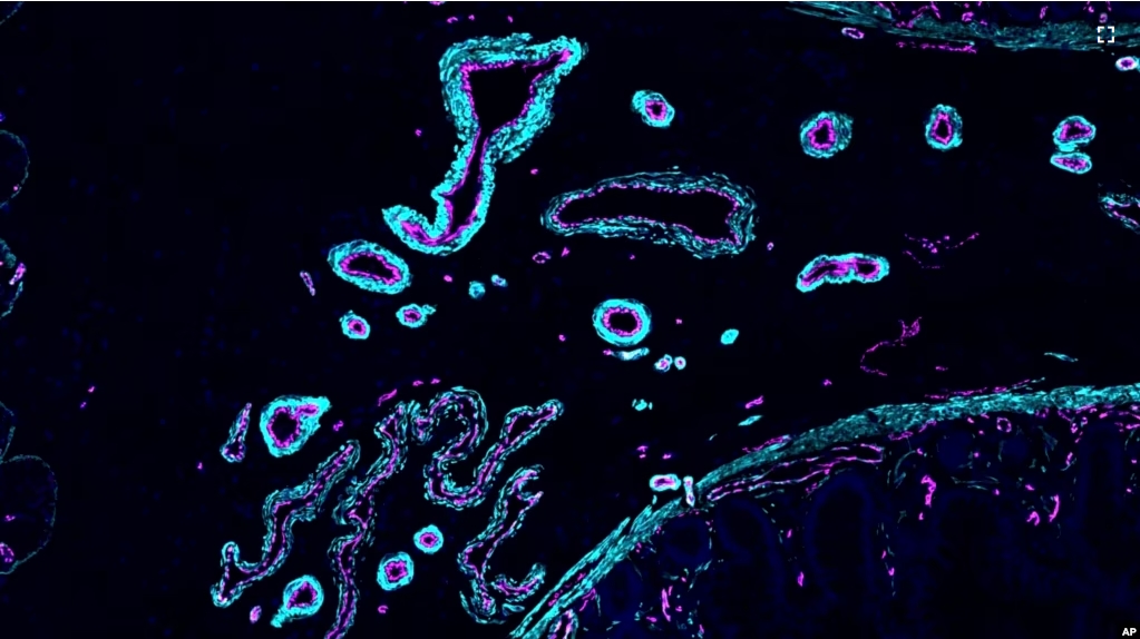 This image provided by Ana-Maria Cujba shows blood vessels in a portion of the human small intestine, March 21, 2024. (Ana-Maria Cujba/Wellcome Sanger Institute via AP)