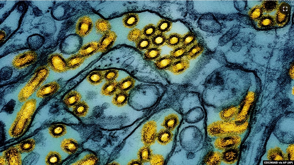 FILE - This colorized electron microscope image released by the National Institute of Allergy and Infectious Diseases on March 26, 2024, shows avian influenza A H5N1 virus particles. (CDC/NIAID via AP, File)